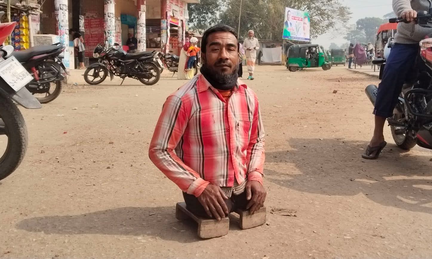 শত কষ্টের মাঝেও মুখে লেগে আছে ম্লান হাসি, যদিও পা দুটো তার নেই। গল্পটা কষ্টের